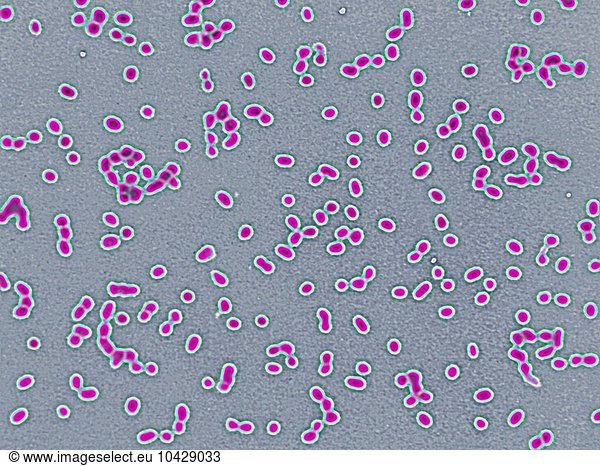 Friedlander´s pneumobacillus (Friedlander´s bacillus) Friedlander´s ...