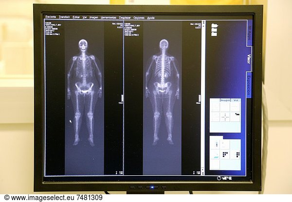 gebraucht  benutzen  Technik  aufspüren  Kontrast  Prüfung  Gesundheitspflege  fangen  Untersuchung  Radioaktivität  2  Trennung  Fotoapparat  Kamera  Abgas  San Sebastian  Spanien  Tomografie