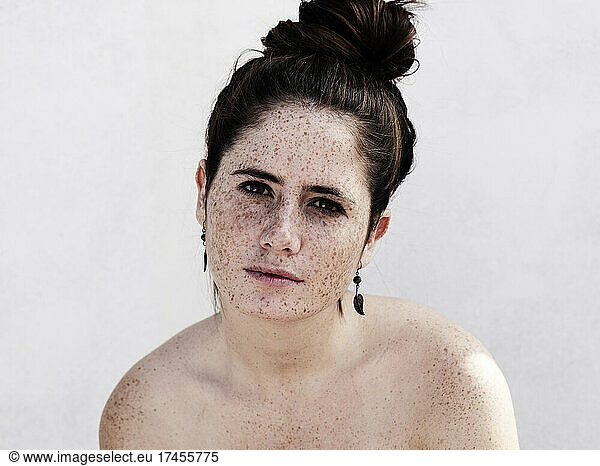 Girl with freckles on face and body