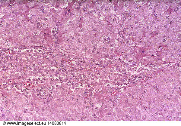 Granulosa Lutein and Theca Lutein Cells (LM) Granulosa Lutein and Theca ...