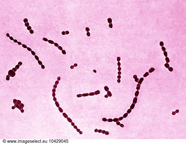 group-a-streptococcus-pyogenes-it-is-the-cause-of-skin-infections