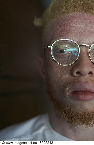 Halbporträt eines Albino-Mannes mit runder Brille