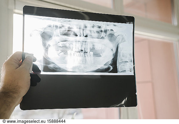 Handhaltendes Röntgenbild eines Kiefers