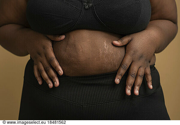 Hands of plus size woman touching belly with stretch marks against beige background