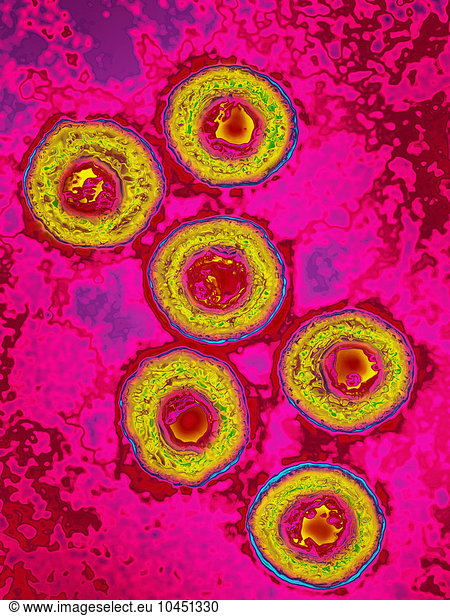 Herpes virus (HSV 1 & 2). Image produced using high-dynamic-range ...