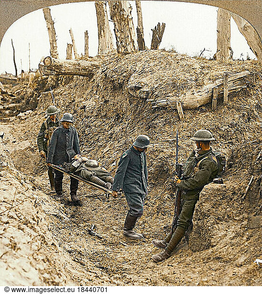 History / First World War / Western Front.British Army.– “German prisoners compelled to carry our wounded during the strenuous struggle for Bourlon Wood Photo (from a stereoscop image)  undated.(Autumn 1917 (?) ).No. 142 of a series of photos  London (Realistic Travels Publishers).Digitally coloured.
