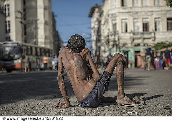 Homeless man with congenital disease in Recife downtown