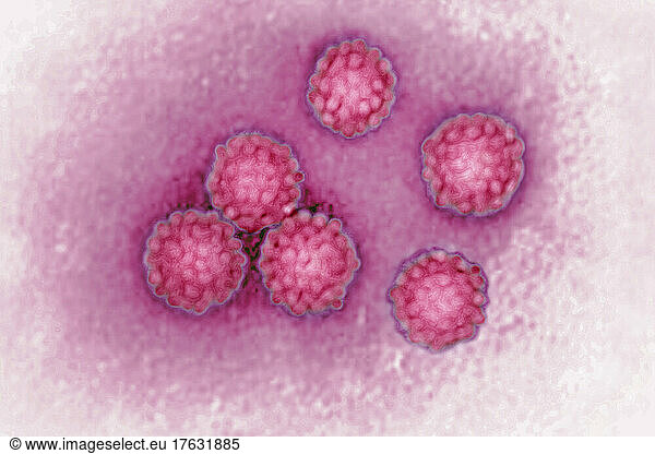 Hpv Human Papillomavirus The Human Papillomavirus Or Hpv Is The Cause Of Sexually Transmitted 7997