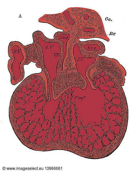 Human Embryo Human Embryo, Heart Development,5 weeks,6 weeks,auriculo ...