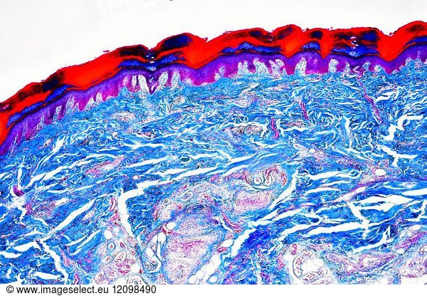 Human skin showing epidermis Human skin showing epidermis, dermis ...