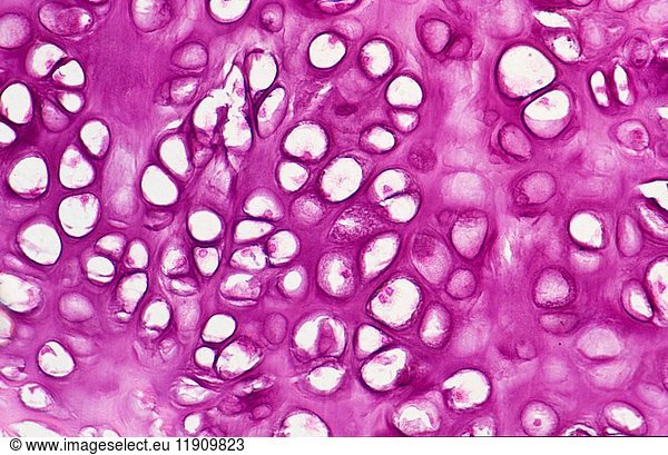 Hyaline cartilage tissue showing chondrocytes and matrix. Optical ...