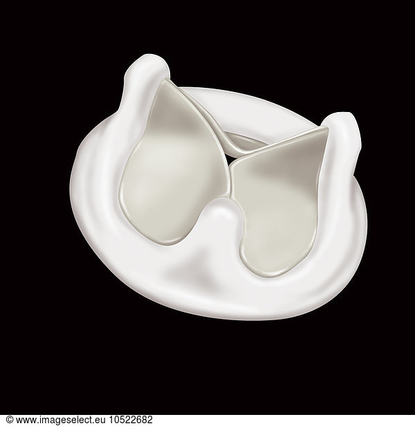 Illustration of a biological heart valve prosthesis. This prosthesis is