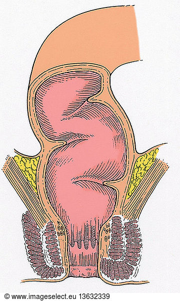 Illustration Of The Rectum In Cross Section Illustration Of The Rectum