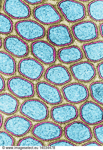 Intestinal Microvilli  TEM