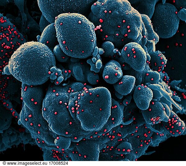 Koloriertes Rasterelektronenmikroskopbild einer apoptotischen Zelle (blau)  die mit SARS-COV-2-Viruspartikeln (rot) infiziert ist und aus einer Patientenprobe isoliert wurde. Das Bild wurde in der NIAID Integrated Research Facility (IRF) in Fort Detrick  Maryland  aufgenommen. Bildnachweis: NIAID.