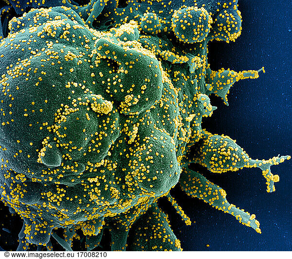 Koloriertes Rasterelektronenmikroskopbild einer apoptotischen Zelle (grün)  die stark mit SARS-COV-2-Viruspartikeln (gelb) infiziert ist und aus einer Patientenprobe isoliert wurde. Das Bild wurde in der NIAID Integrated Research Facility (IRF) in Fort Detrick  Maryland  aufgenommen. Bildnachweis: NIAID.