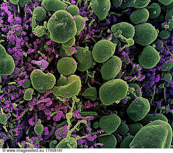 Koloriertes Rasterelektronenmikroskopbild einer apoptotischen Zelle (grün)  die stark mit SARS-CoV-2-Viruspartikeln (lila) infiziert ist und aus einer Patientenprobe isoliert wurde. Das Bild wurde in der NIAID Integrated Research Facility (IRF) in Fort Detrick  Maryland  aufgenommen. Bildnachweis: NIAID.