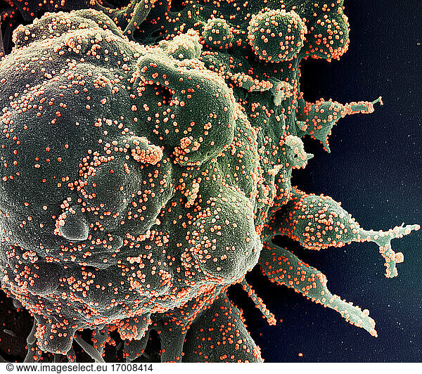Koloriertes Rasterelektronenmikroskopbild einer apoptotischen Zelle (grün)  die stark mit SARS-COV-2-Viruspartikeln (orange) infiziert ist und aus einer Patientenprobe isoliert wurde. Das Bild wurde in der NIAID Integrated Research Facility (IRF) in Fort Detrick  Maryland  aufgenommen. Bildnachweis: NIAID.