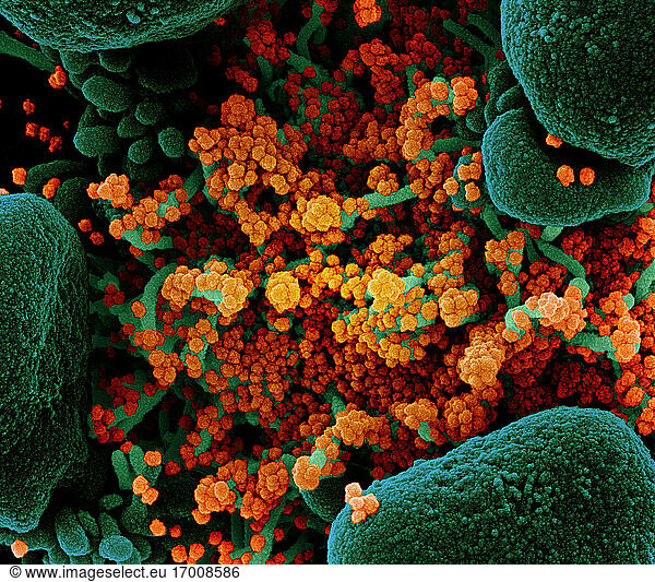 Koloriertes Rasterelektronenmikroskopbild einer apoptotischen Zelle (grün)  die stark mit SARS-CoV-2-Viruspartikeln (orange) infiziert ist und aus einer Patientenprobe isoliert wurde. Das Bild wurde in der NIAID Integrated Research Facility (IRF) in Fort Detrick  Maryland  aufgenommen. Bildnachweis: NIAID.