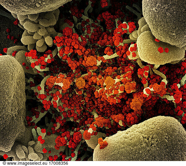 Koloriertes Rasterelektronenmikroskopbild einer apoptotischen Zelle (hellbraun)  die stark mit SARS-CoV-2-Viruspartikeln (orange) infiziert ist und aus einer Patientenprobe isoliert wurde. Das Bild wurde in der NIAID Integrated Research Facility (IRF) in Fort Detrick  Maryland  aufgenommen. Bildnachweis: NIAID.