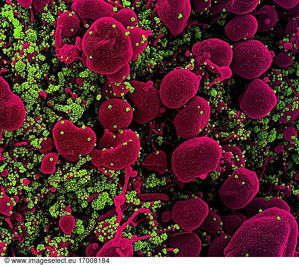 Koloriertes Rasterelektronenmikroskopbild einer apoptotischen Zelle (rosa)  die stark mit SARS-CoV-2-Viruspartikeln (grün) infiziert ist und aus einer Patientenprobe isoliert wurde. Das Bild wurde in der NIAID Integrated Research Facility (IRF) in Fort Detrick  Maryland  aufgenommen. Bildnachweis: NIAID.