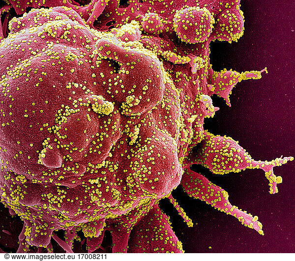Koloriertes Rasterelektronenmikroskopbild einer apoptotischen Zelle (rot)  die stark mit SARS-COV-2-Viruspartikeln (gelb) infiziert ist und aus einer Patientenprobe isoliert wurde. Das Bild wurde in der NIAID Integrated Research Facility (IRF) in Fort Detrick  Maryland  aufgenommen. Bildnachweis: NIAID.