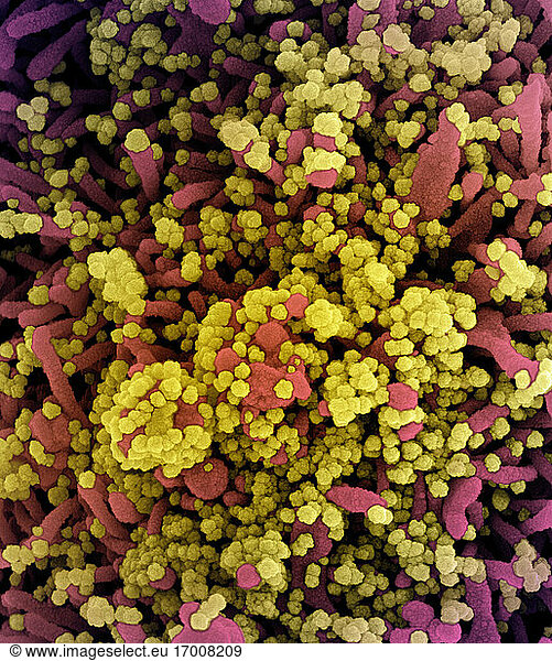 Koloriertes Rasterelektronenmikroskopbild einer Zelle  die stark mit SARS-CoV-2-Viruspartikeln (gelb) infiziert ist und aus einer Patientenprobe isoliert wurde. Das Bild wurde in der NIAID Integrated Research Facility (IRF) in Fort Detrick  Maryland  aufgenommen. Bildnachweis: NIAID.