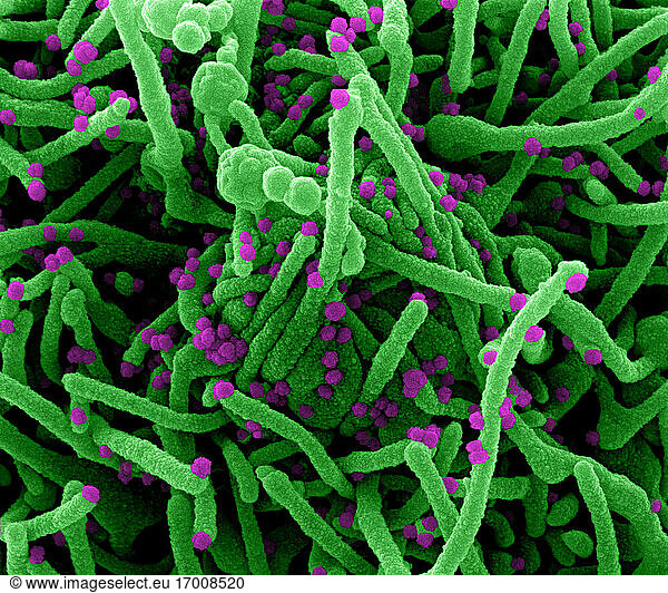 Koloriertes Rasterelektronenmikroskopbild einer Zelle (grün)  die mit SARS-CoV-2-Viruspartikeln (violett) infiziert ist und aus einer Patientenprobe isoliert wurde. Das Bild wurde in der NIAID Integrated Research Facility (IRF) in Fort Detrick  Maryland  aufgenommen. Bildnachweis: NIAID.