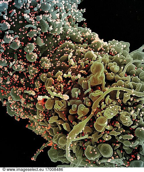 Koloriertes Rasterelektronenmikroskopbild einer Zelle mit morphologischen Anzeichen von Apoptose  infiziert mit SARS-COV-2-Viruspartikeln (orange)  isoliert aus einer Patientenprobe. Das Bild wurde in der NIAID Integrated Research Facility (IRF) in Fort Detrick  Maryland  aufgenommen. Bildnachweis: NIAID.