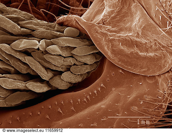 Kräftige Stacheln an den Kiemenrädern eines Krebses (Crustacea: Decapoda)  aufgenommen im Rasterelektronenmikroskop
