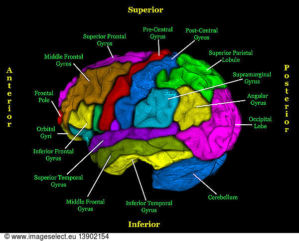 Labeled MRI of Normal Brain Labeled MRI of Normal Brain,brain,colorised ...