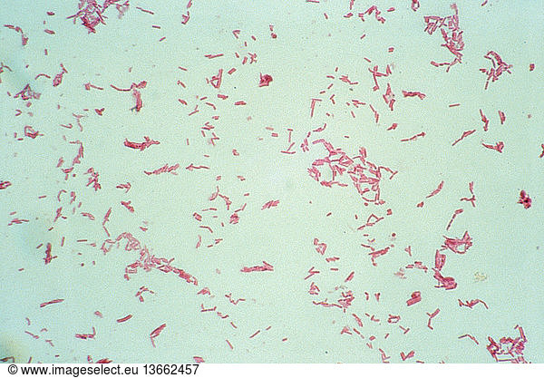 Light micrograph (LM) showing the bacteria species Mycotabcterium ...