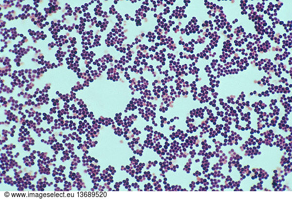 Light micrograph of gram negative bacteria Light micrograph of gram ...