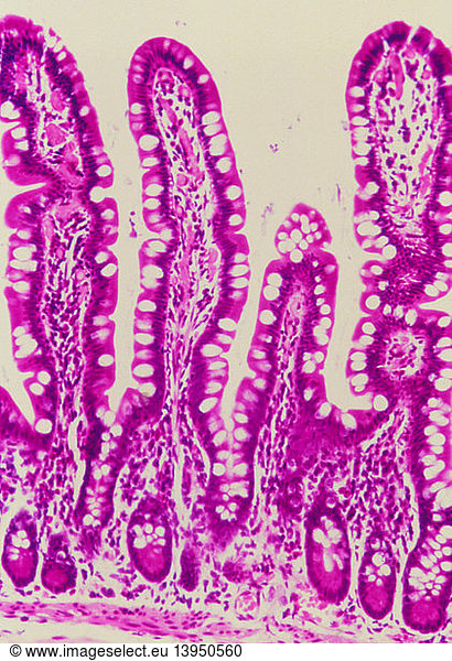 LM of a section through intestinal villi & crypts