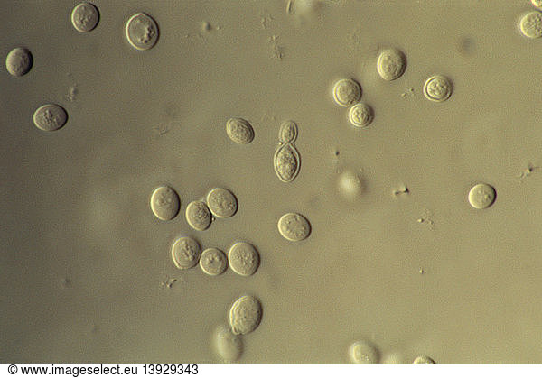 LM of Saccharomyces Cerevisiae LM of Saccharomyces Cerevisiae ...