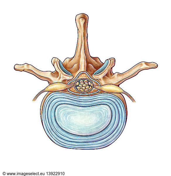 Lumbar Vertebra and Disk Lumbar Vertebra and Disk, illustration ...