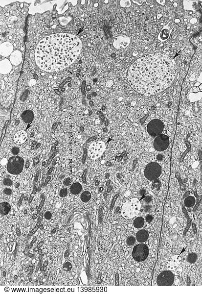 Lysosomes (TEM) Lysosomes (TEM),anatomy,cellular anatomy,electron ...