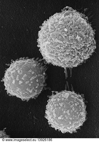 Macrophage and Lymphocytes  SEM