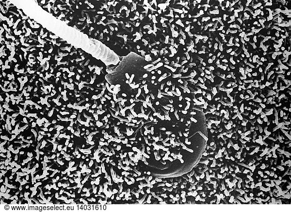 Mammalian Fertilization  SEM