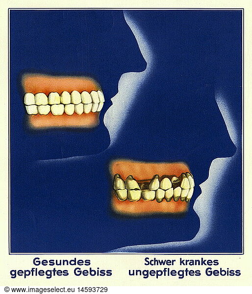 medicine  dentistry  healthily teeth  sets of teeth  ill teeth  illustrated display  Germany  circa 1935