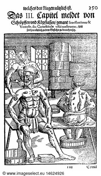medicine  treatment  examination / therapy / consultation  cupping as therapy against eye complaints  woodcut  from: Georg Bartisch (1535 - 1607)  'Ophthalmoduleia  das ist Augendienst  Dresden  1583