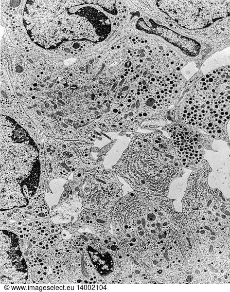 Microvilli and cilia in islet cell  TEM