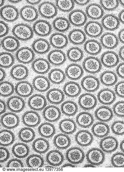 Microvilli on Intestinal Epithelial Cell in Cross-section TEM