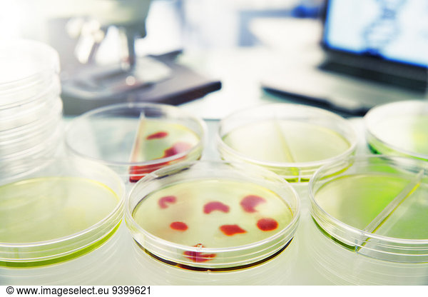 Nahaufnahme von Kulturen in Petrischalen im Labor