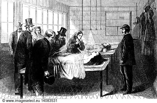 New York City Morgue  Bellevue Hospital  1866