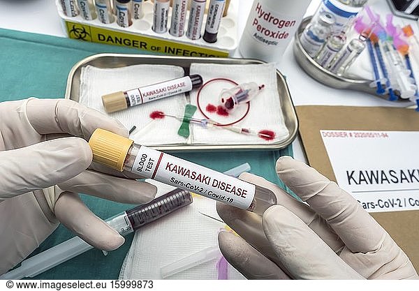 Nurse holds blood sample to treat Sars-CoV-2-related Kawasaki disease in children under five  conceptual image  unbranded generic drug containers and hypothetical bar codes.