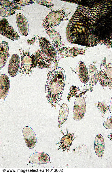 Parasitic Tracheal Mites Of Honey Bees Parasitic Tracheal Mites Of Honey Beesacarapis Woodi 7315