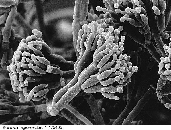 Penicillium camembertii (SEM) Penicillium camembertii (SEM),conidia ...