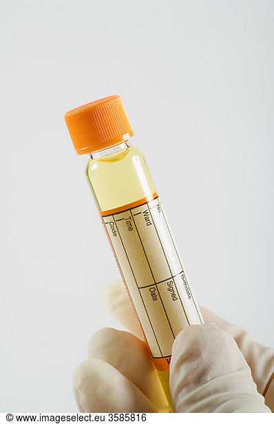 Person holding urine sample