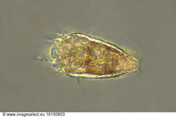 Photomicrograph of a mite (Aculops lycopersici); They are very small